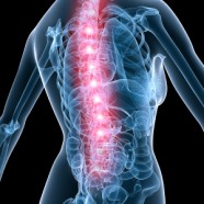 What’s a Subluxation?